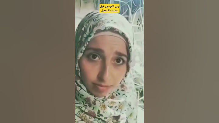 بنين الموسوي قبل لتسوي عمليات التجميل 😂😍