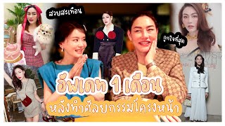 สวยสะเทือน! อัพเดทโครงหน้าหลังทำมา 1 เดือน นี้แหละที่ถูกใจ ✨ | Nampraw Family