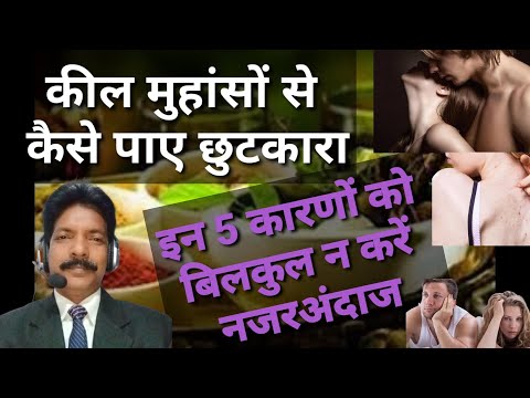 मुहांसों को जल्दी कैसे दूर करें | How to remove pimples Fast | DR. Anil