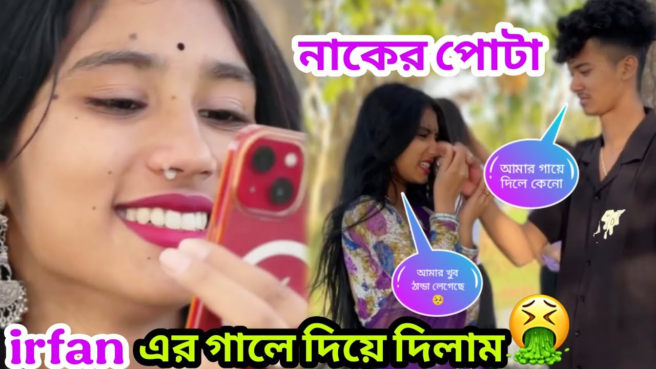 নাকের পোটা irfan এর গালে দিয়ে দিলাম 🤮@Jimroyofficial1