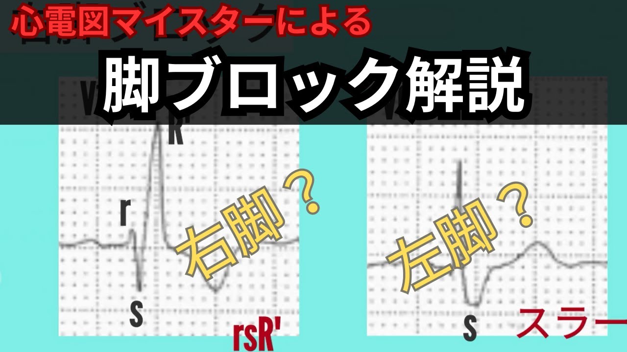 心電図検定マイスターDr.Fのアニメでわかる心電図塾・脚ブロック初級編