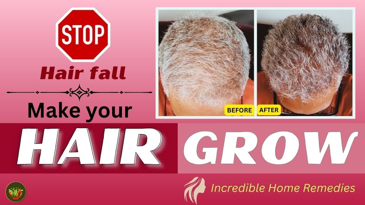 How to relief from hair fall I Quick Ways to Stop Hair Loss Hair Fall