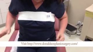How To Use a Breast Displacement Strap After Breast Augmentation