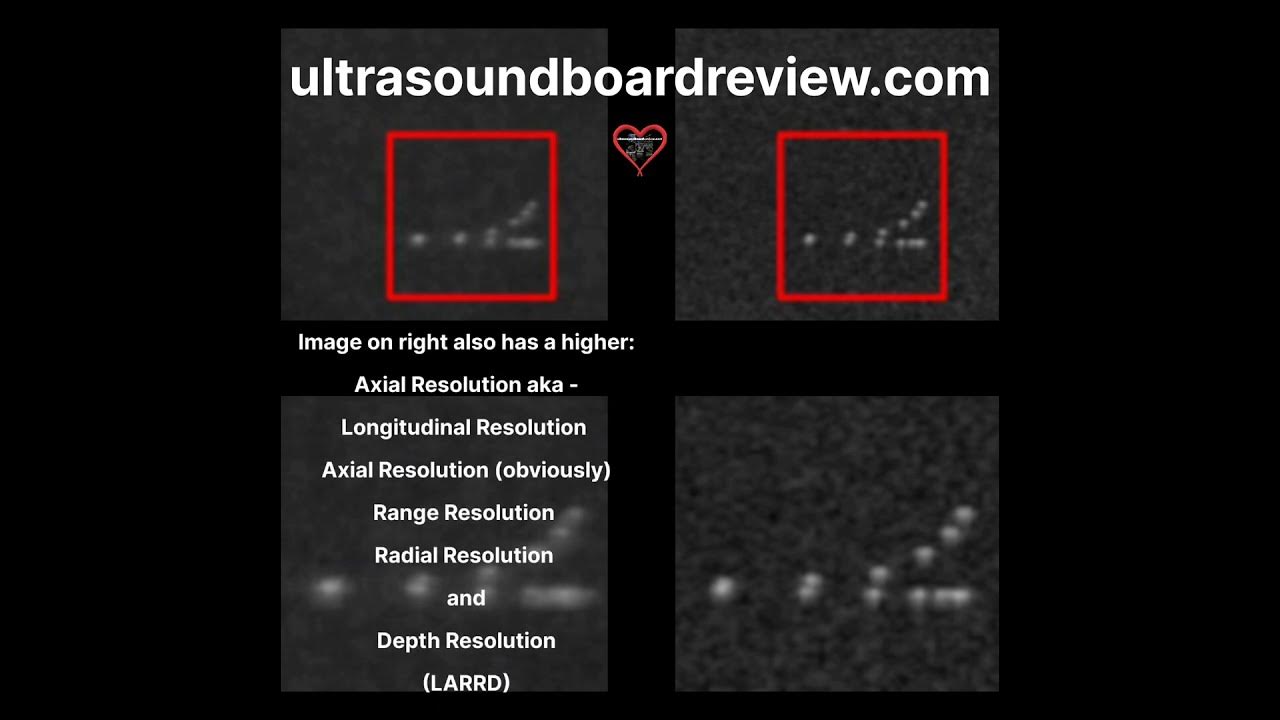 Ultrasound phantom spi secrets youtube