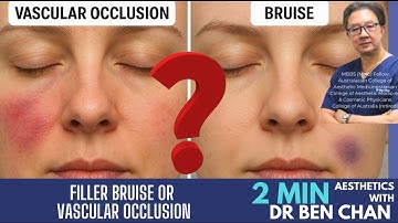 Vascular occlusion or bruise? Part 1
