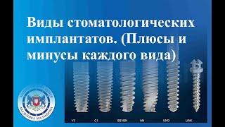 картинка: Виды стоматологических имплантатов.  Плюсы и минусы каждого вида