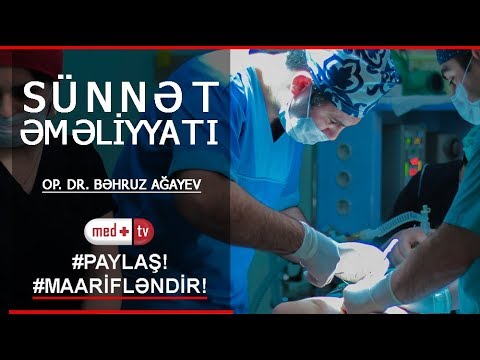 Op. Dr. Behruz Agayev - Sunnet emeliyyati - Medplus TV