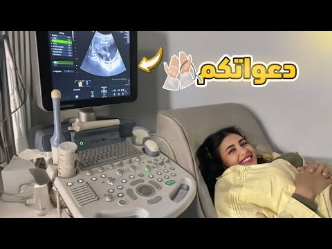 اول مره اشوف البيبي واسمع نبضات قلبه جوزي بكي من الفرحه