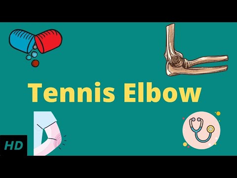 Vidéo: Tennis Elbow: Causes, Symptômes Et Diagnostic