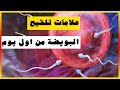 علامات تلقيح البويضة من اول يوم