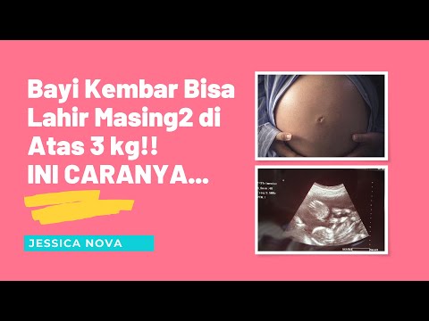 Bayi Kembar Bisa Lahir di Atas 3 kg! Ini Cara Ampuh Menaikkan Berat Badan Janin