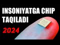 YANGI DAVR BOSHLANMOQDA, INSONLARGA MIKROCHIP OʻRNATILMOQDA. SIZ XAM TAYYOR TURING!