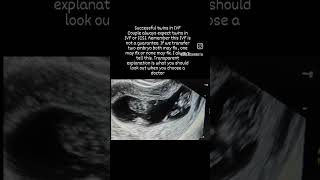 Twins IVF pregnancy/ICSI is it always twins? #twins #ivfsuccesshospital #pregnancy #draishwarya