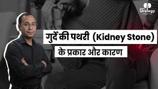 Types and Causes of Kidney Stone in Hindi | Delhi Urology Hospital | Dr. Niren Rao