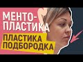 Скошенный подбородок 👩🏻 Пластика подбородка 🔥 МЕНТОПЛАСТИКА