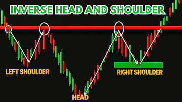Master the Head and Shoulders Pattern | Full Trading Strategy Explained Step-by-Step