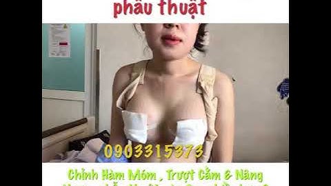 NÂNG NGỰC, HÀM MÓM & TRƯỢT CẰM Review So sánh mức độ đau khi phẫu thuật cùng 1 lúc