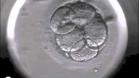 Embryoscope timelapse DanFert.dk