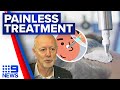 New painless and non-surgical skin cancer treatment to become available | 9 News Australia