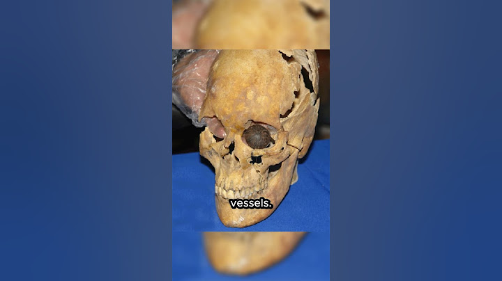 This 5,000-Year-Old Eye Shocked Archaeologists