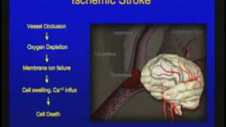 Vascular Disorders of the Central Nervous System