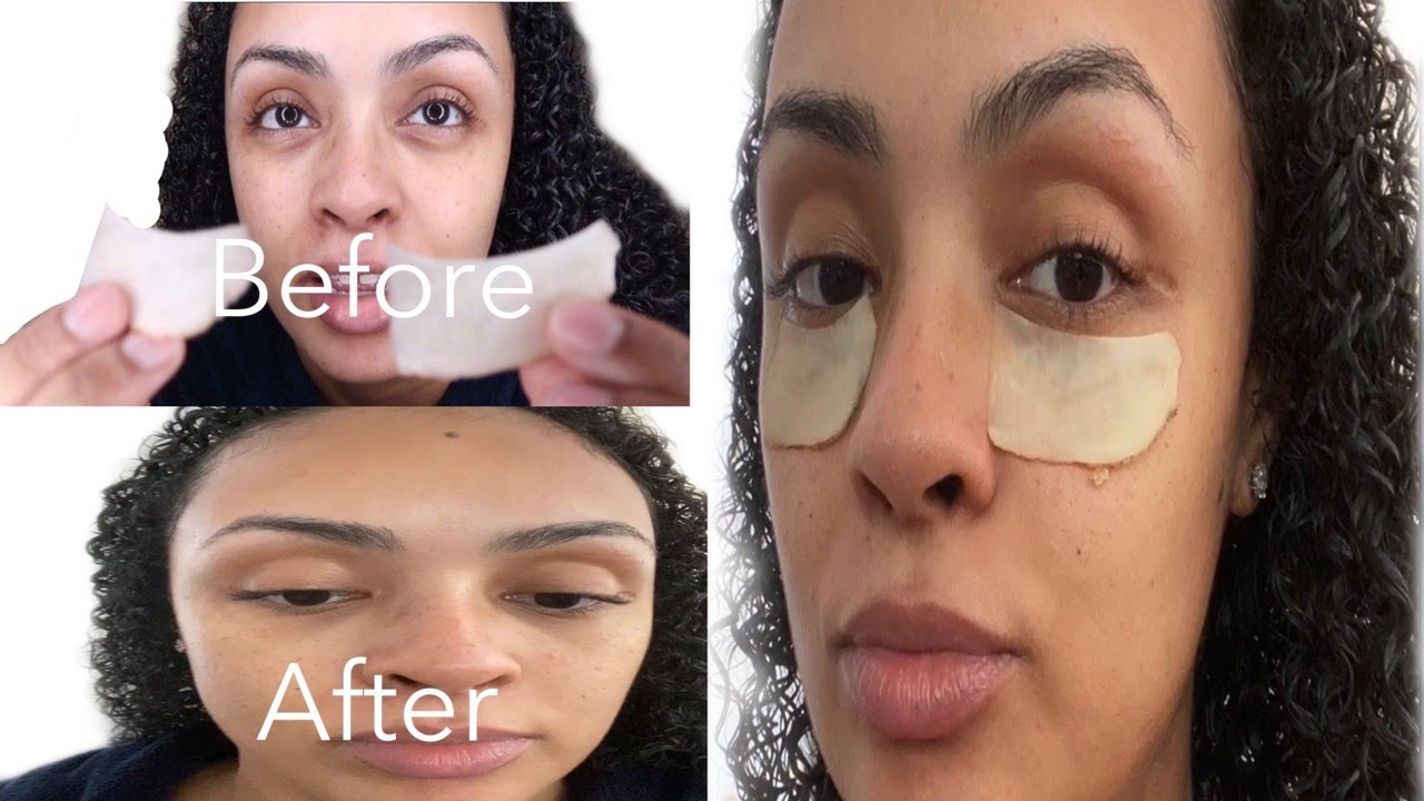 Instantly Remove Dark Circles And Puffiness Under Eye Diy Cold