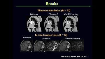 ISMRM MR Academy - Applications: Image Acquisition & Reconstruction