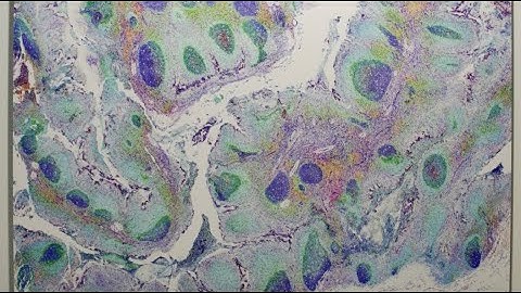 The Immune Landscape