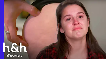 O que pode causar inchaço nas nádegas?