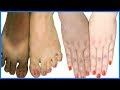 100% Effective Full Body Whitening Treatment Naturally At Home| Permanent Full Body Whitening Remedy