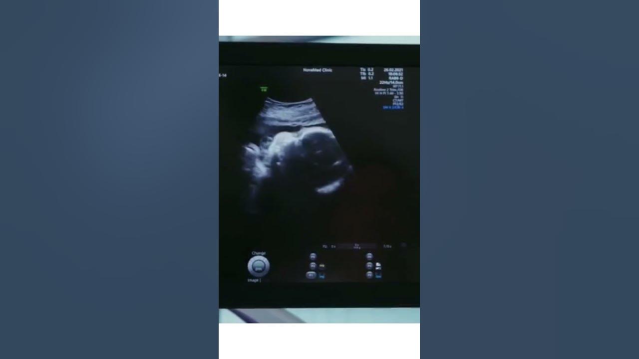 "The Amazing Science of Fetal Hearing Your Baby Can Hear You in the