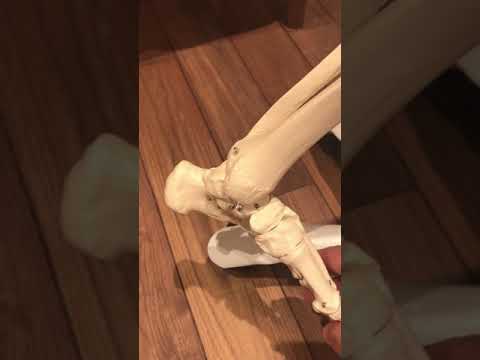 Плоскостопие. Упражнения и причины