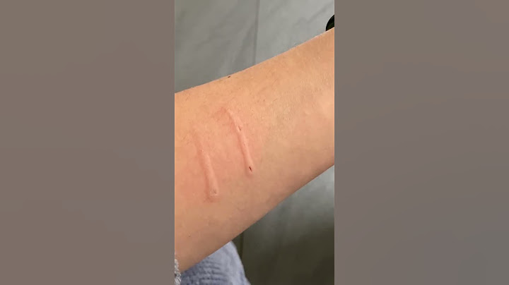 Cat aggressively bites owner and then says sorry  #cat  #cats #shorts
