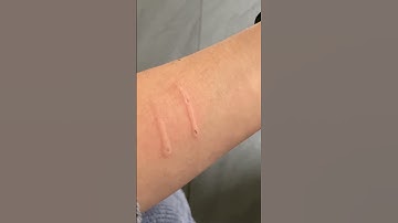 Thumbnail of Cat aggressively bites owner and then says sorry  #cat  #cats #shorts