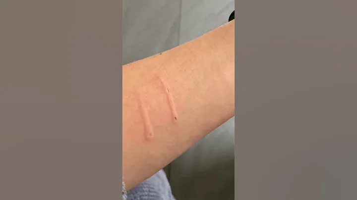 Cat aggressively bites owner and then says sorry  #cat  #cats #shorts