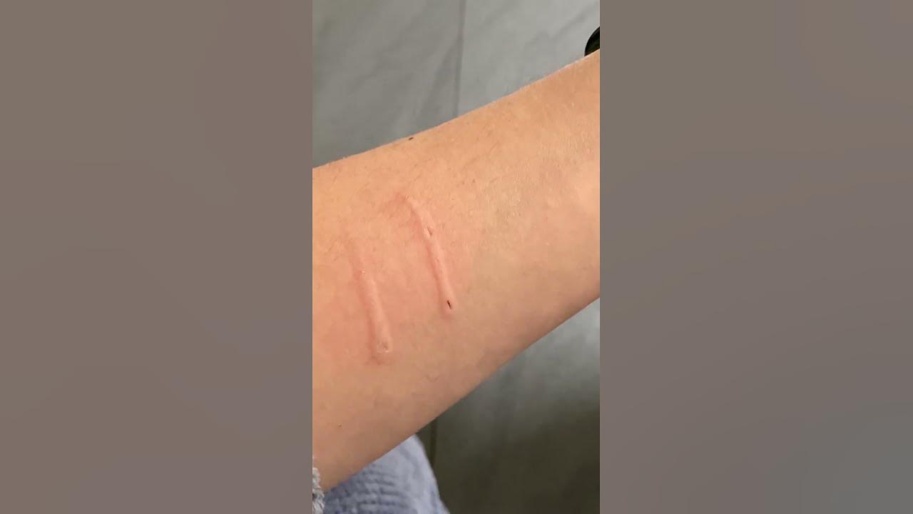 Cat aggressively bites owner and then says sorry  #cat  #cats #shorts