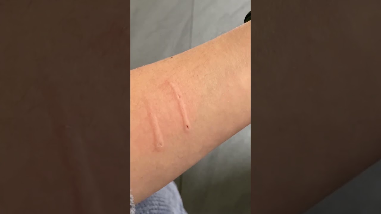 Cat aggressively bites owner and then says sorry  #cat  #cats #shorts