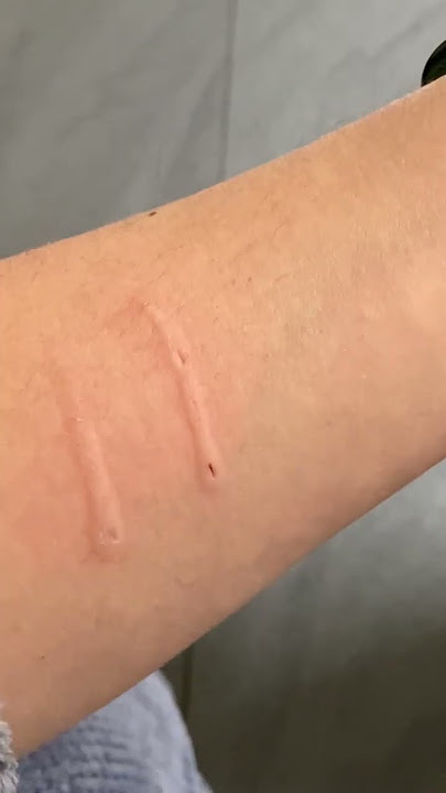 Cat aggressively bites owner and then says sorry  #cat  #cats #shorts