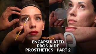 Learn to Make Encapsulated Pros-Aide Prosthetics - Part 2 - PREVIEW