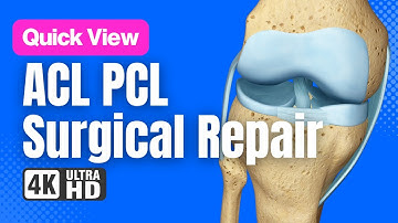 ACL PCL Surgical Reconstruction // See How It Works // 3D Animation
