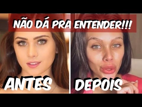 🔥FLÁVIA PAVANELLI VIRALIZA NA INTERNET DEPOIS DE PROCEDIMENTOS “GASTOU
