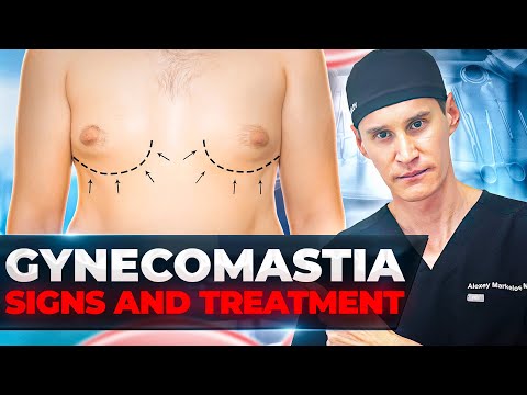 How To Know If You Have Gynecomastia? Causes, Signs and Symptoms, Diagnosis and Treatment.