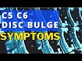 What Are The Symptoms Of A Bulging Disc In The Neck? C5 C6 Disc Bulge Symptoms? | Dr Walter Salubro