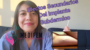 ¿Cuándo empiezan los efectos secundarios de los implantes?