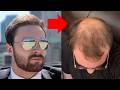 BALDING DESTROYED MY CONFIDENCE - Here's How I Got It Back