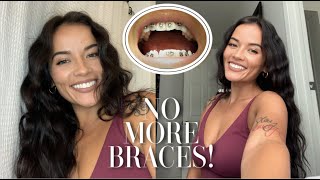 GETTING MY BRACES OFF AFTER 4 YEARS! | BEFORE &amp; AFTER PICS