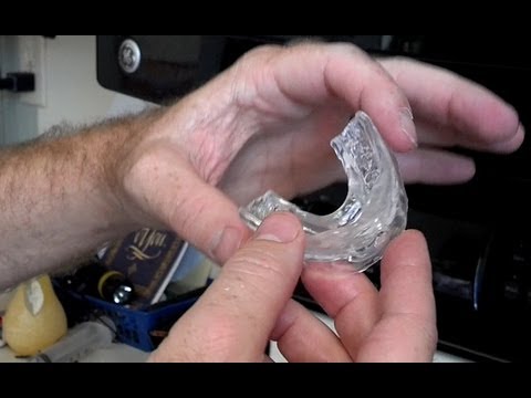 How To Mold Snoring Mouthpiece | VItalSleep Fitting Instructions