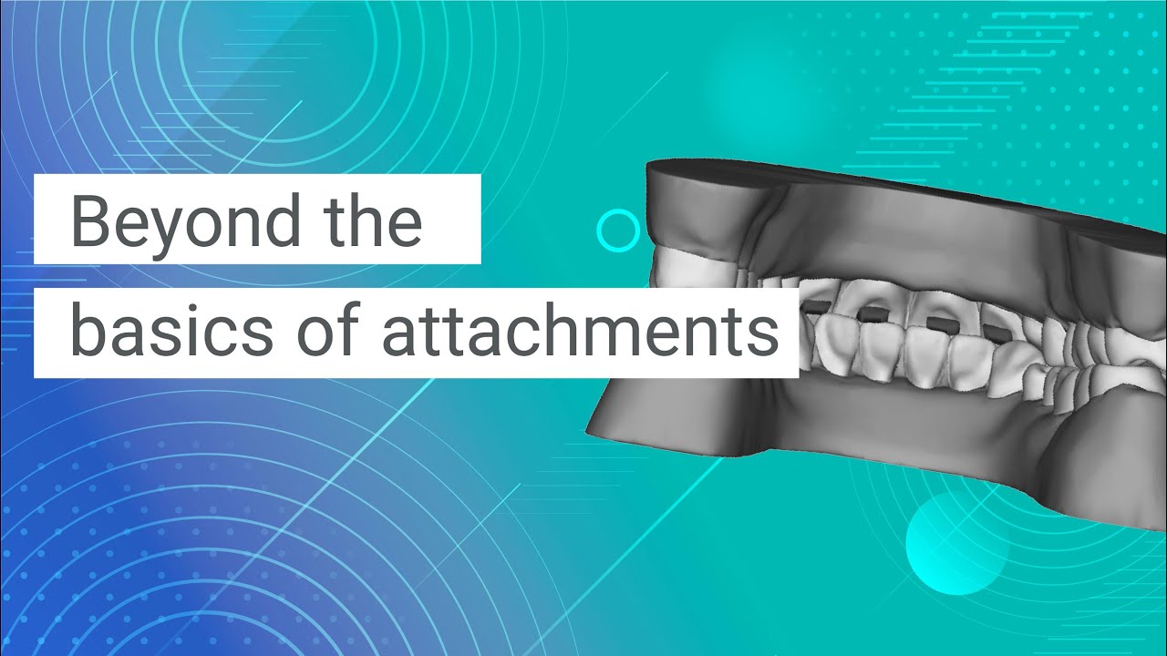 The Art of Attachments in Clear Aligner Orthodontics (+ Experts' Tips)