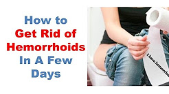 Best Hemorrhoids Treatment, How To Get Rid Of Hemorrhoids Fast, The Piles & Hemorrhoid Cream I Used