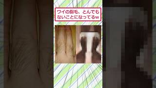 My Finger Hair Is In A Terrible State Lol 2chfunnythreads 2ch 5ch shorts